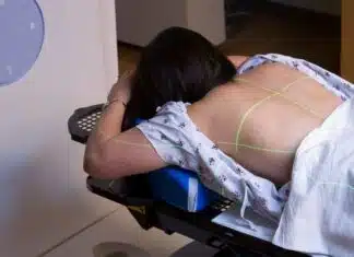 NovaGray - Traitements pour les brulures causées par la radiothérapie